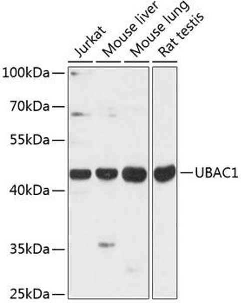 Signal Transduction Antibodies 1 Anti-UBAC1 Antibody CAB13071