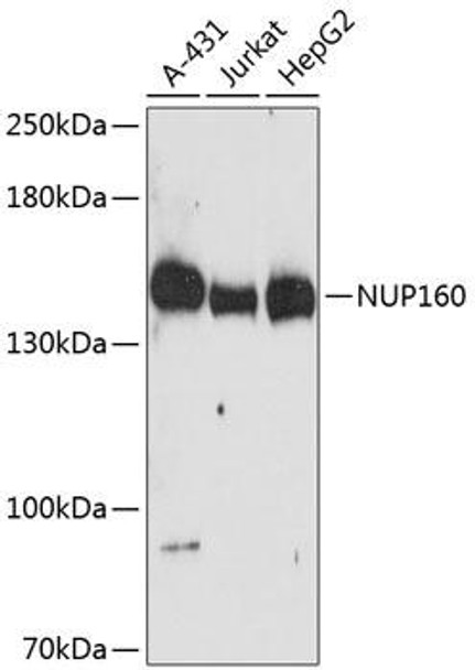 Epigenetics and Nuclear Signaling Antibodies 1 Anti-NUP160 Antibody CAB13080