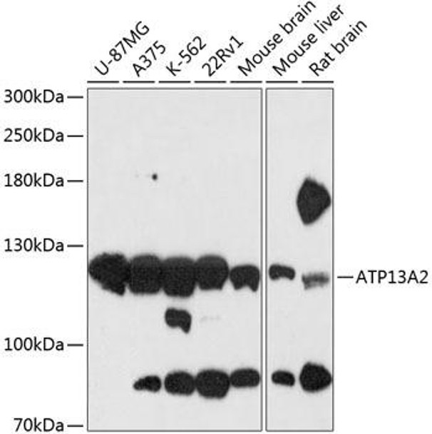 Cell Biology Antibodies 3 Anti-ATP13A2 Antibody CAB13083