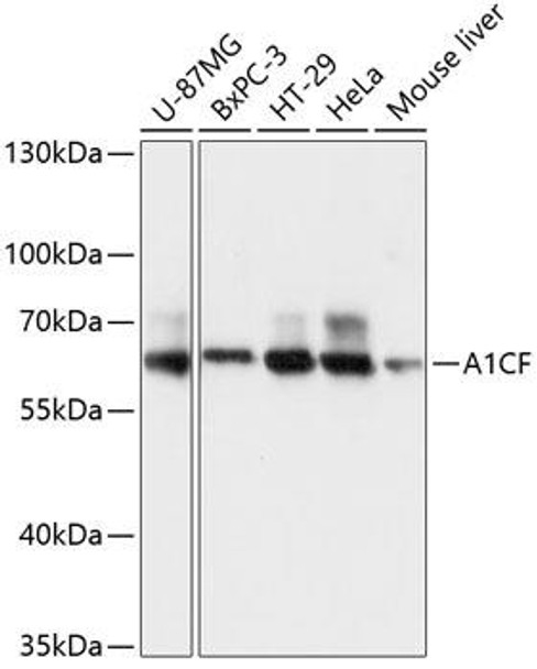 Epigenetics and Nuclear Signaling Antibodies 1 Anti-A1CF Antibody CAB13087