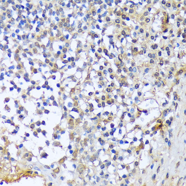 Epigenetics and Nuclear Signaling Antibodies 1 Anti-A1CF Antibody CAB13087