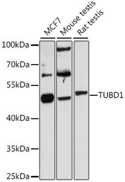 Cell Biology Antibodies 3 Anti-TUBD1 Antibody CAB13091