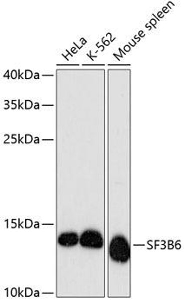 Epigenetics and Nuclear Signaling Antibodies 1 Anti-SF3B6 Antibody CAB13097