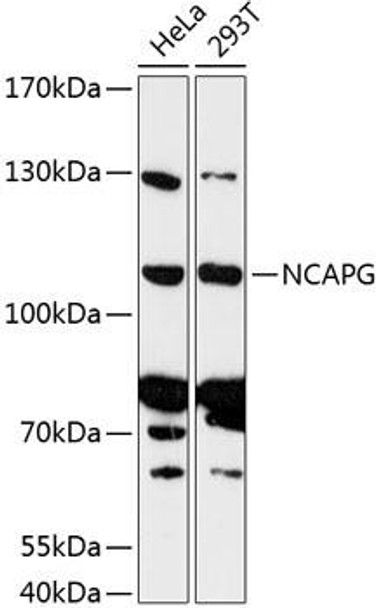 Cell Cycle Antibodies 1 Anti-NCAPG Antibody CAB13123