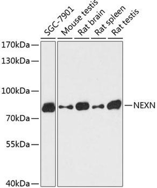 Cell Biology Antibodies 3 Anti-NEXN Antibody CAB13136