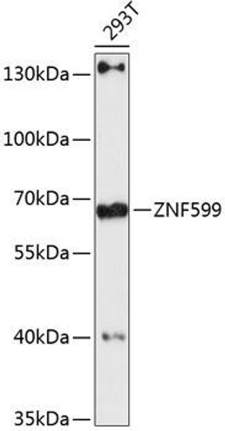 Epigenetics and Nuclear Signaling Antibodies 1 Anti-ZNF599 Antibody CAB13140