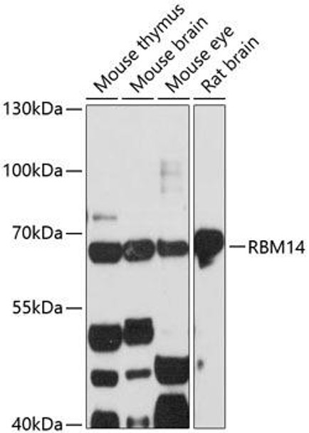 Immunology Antibodies 1 Anti-RBM14 Antibody CAB13159