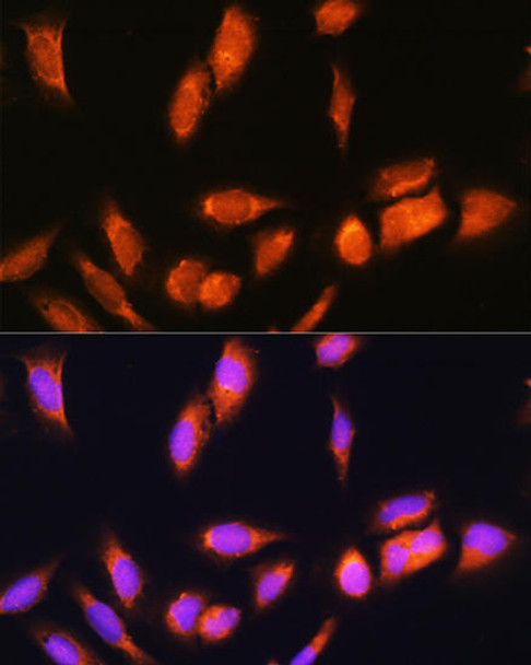 Cell Biology Antibodies 3 Anti-SCYL2 Antibody CAB13178