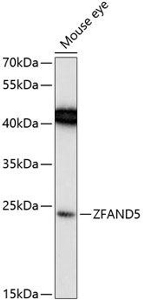 Signal Transduction Antibodies 1 Anti-ZFAND5 Antibody CAB13185