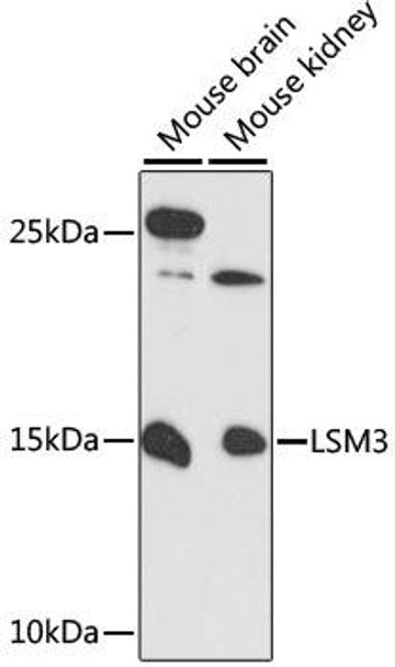 Epigenetics and Nuclear Signaling Antibodies 1 Anti-LSM3 Antibody CAB13189