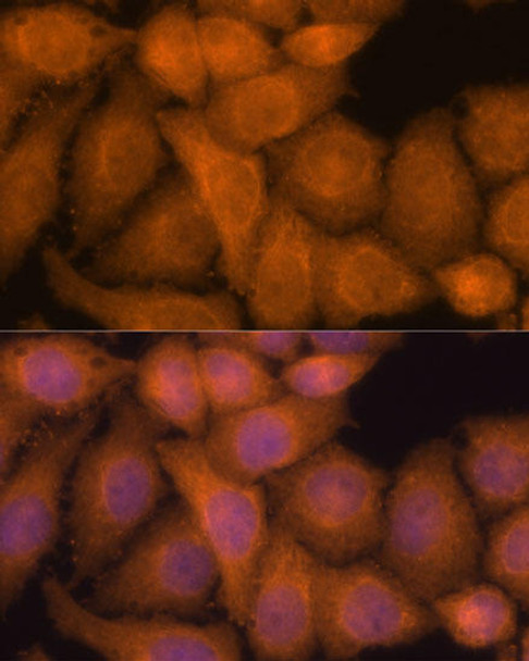 Cell Biology Antibodies 3 Anti-ZC3H7A Antibody CAB13190