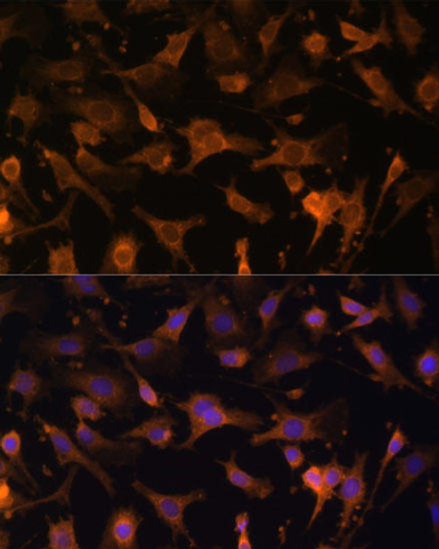 Signal Transduction Antibodies 1 Anti-UFC1 Antibody CAB13192