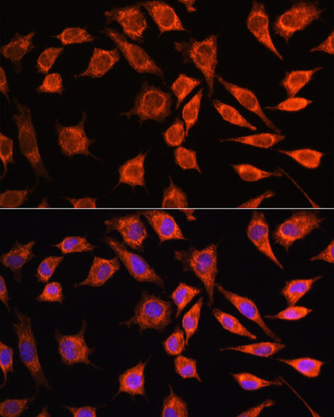Cell Biology Antibodies 3 Anti-MRPL45 Antibody CAB13197