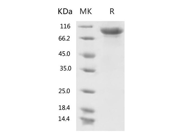 Recombinant 2019-nCoV S1 Protein His Tag