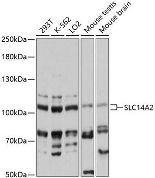 Signal Transduction Antibodies 1 Anti-SLC14A2 Antibody CAB13208