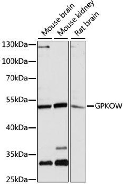 Epigenetics and Nuclear Signaling Antibodies 1 Anti-GPKOW Antibody CAB13214