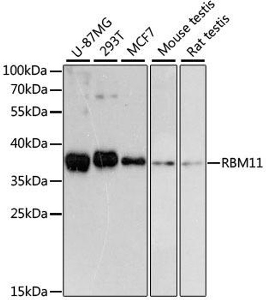 Developmental Biology Anti-RBM11 Antibody CAB13216