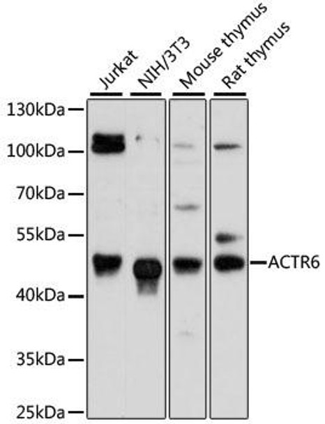 Cell Biology Antibodies 3 Anti-ACTR6 Antibody CAB13227