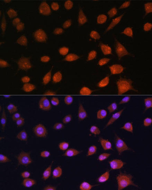 Cell Biology Antibodies 3 Anti-RPS19BP1 Antibody CAB13231