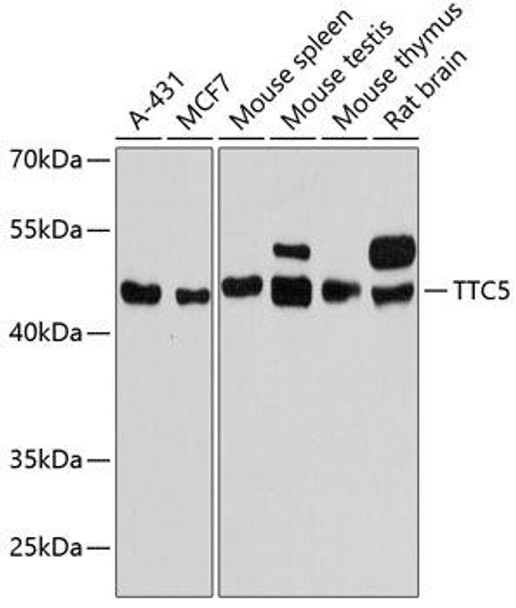 Epigenetics and Nuclear Signaling Antibodies 1 Anti-TTC5 Antibody CAB13232