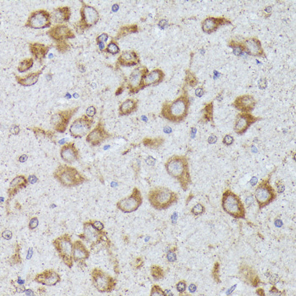 Developmental Biology Anti-TBCB Antibody CAB13248