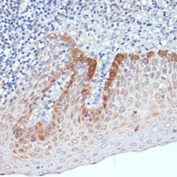 Cell Biology Antibodies 3 Anti-CXCL12 Antibody CAB1325