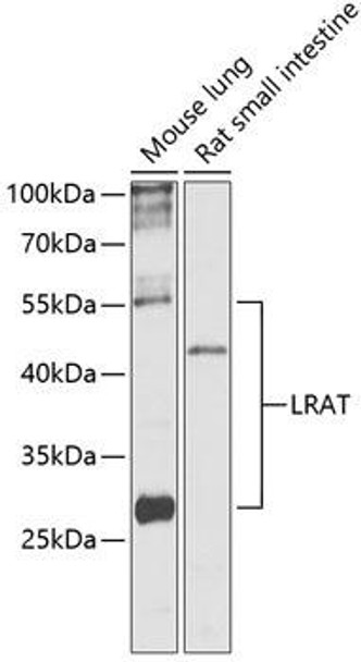 Signal Transduction Antibodies 1 Anti-LRAT Antibody CAB13256