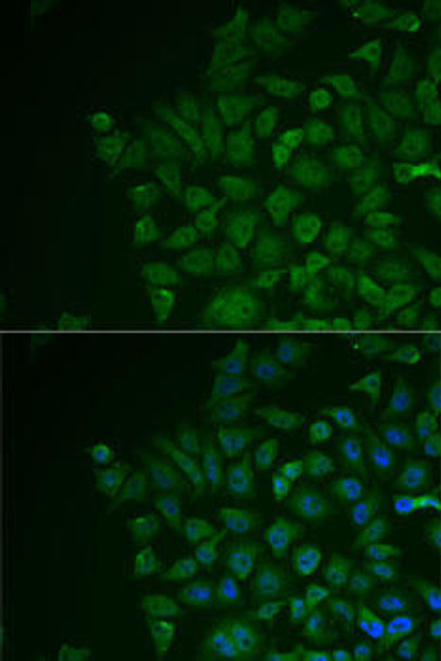 Signal Transduction Antibodies 1 Anti-LRAT Antibody CAB13256