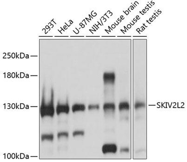Epigenetics and Nuclear Signaling Antibodies 1 Anti-SKIV2L2 Antibody CAB13258