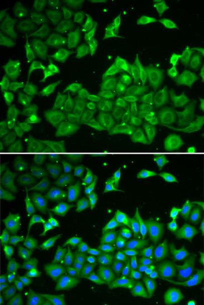 Cell Biology Antibodies 3 Anti-ALDH3A1 Antibody CAB13275