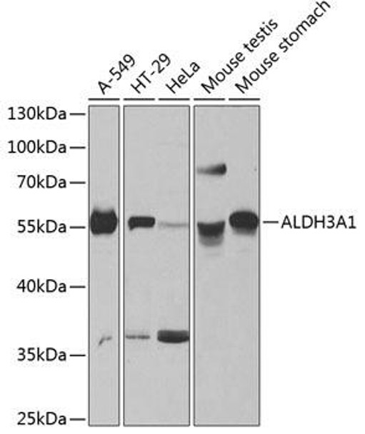 Cell Biology Antibodies 3 Anti-ALDH3A1 Antibody CAB13275