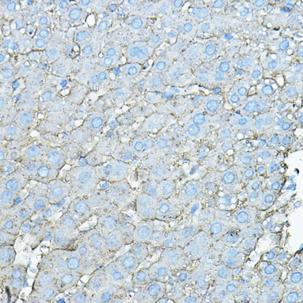 Cell Biology Antibodies 3 Anti-ASGR1 Antibody CAB13279