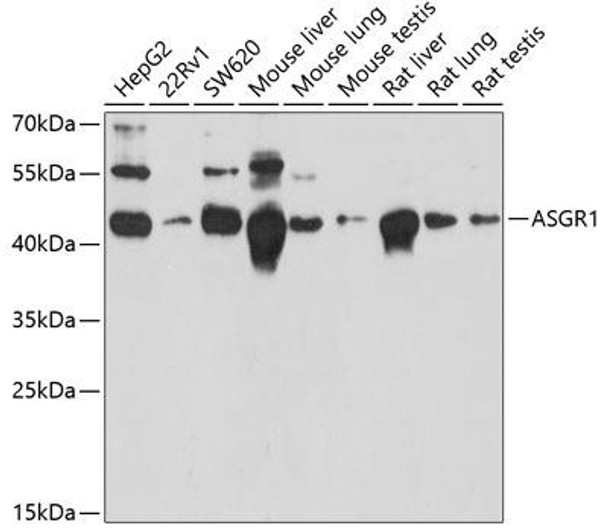 Cell Biology Antibodies 3 Anti-ASGR1 Antibody CAB13279