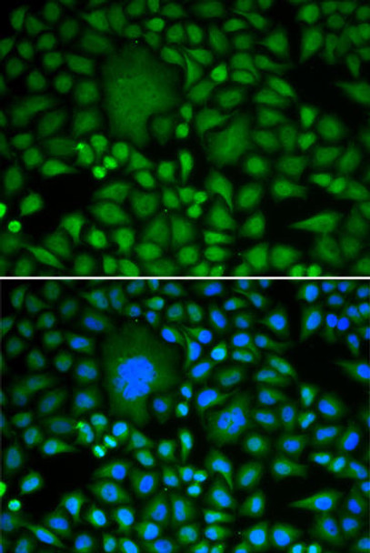 Cell Biology Antibodies 3 Anti-DDX5 Antibody CAB13294