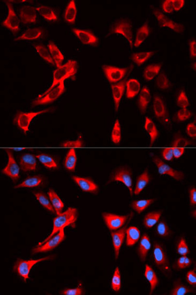 Metabolism Antibodies 1 Anti-EIF4B Antibody CAB13300