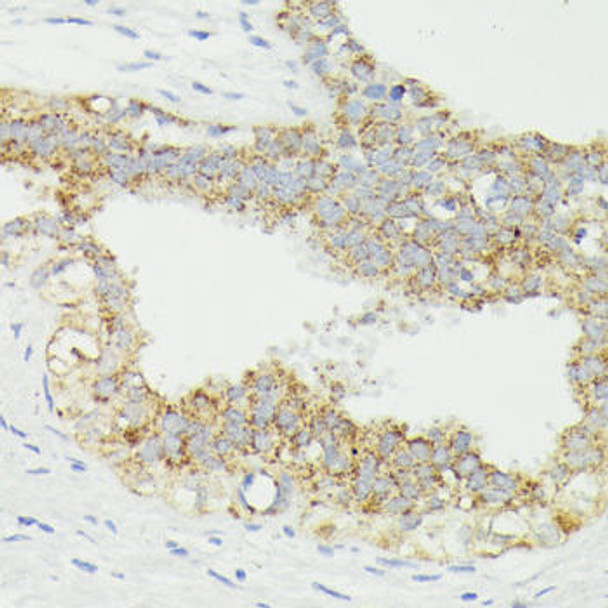 Cell Biology Antibodies 16 Anti-CD168 Antibody CAB13315