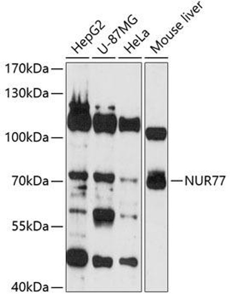 Epigenetics and Nuclear Signaling Antibodies 1 Anti-NUR77 Antibody CAB13316