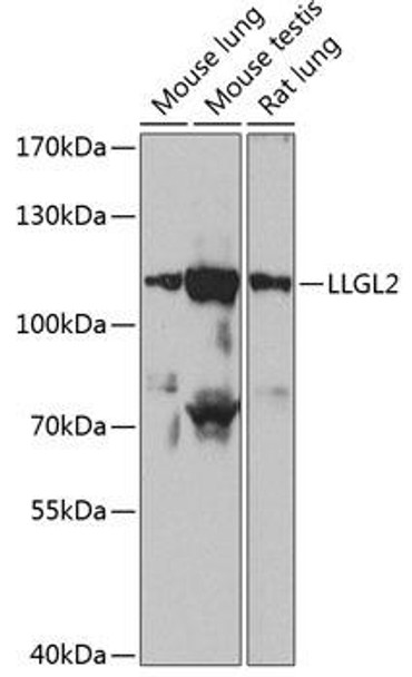 Cell Biology Antibodies 16 Anti-LLGL2 Antibody CAB13323