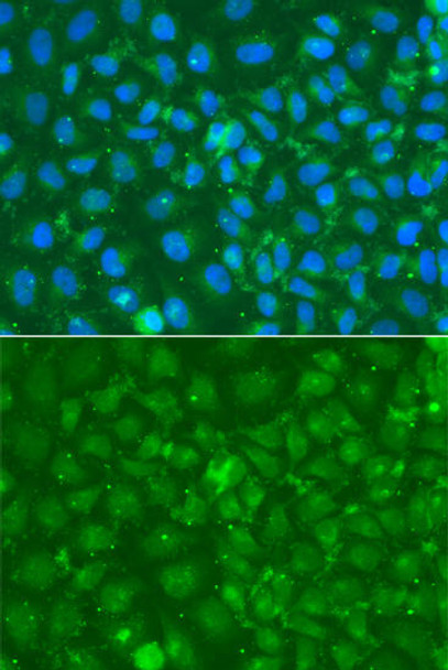 Cell Death Antibodies 1 Anti-SRGN Antibody CAB13340