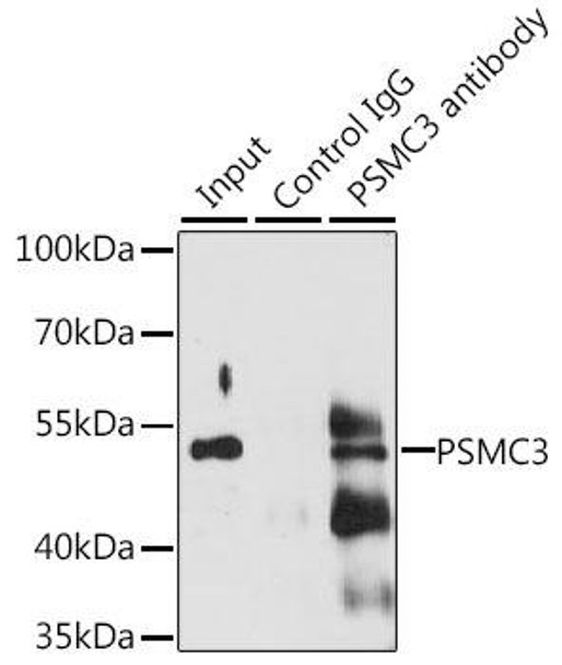 Immunology Antibodies 1 Anti-PSMC3 Antibody CAB13345