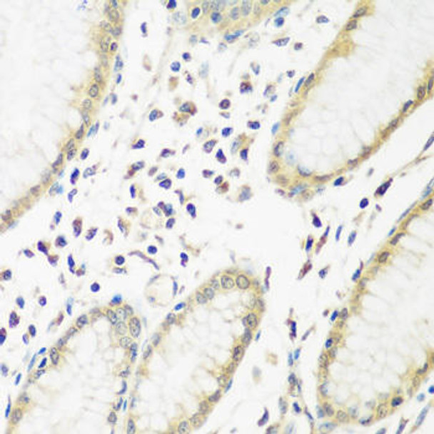 Metabolism Antibodies 1 Anti-PYCR1 Antibody CAB13346