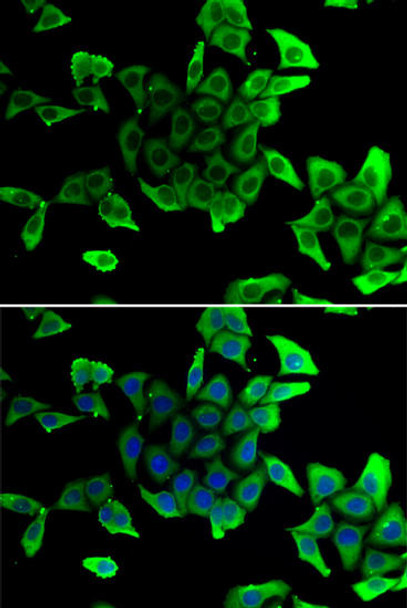 Cell Biology Antibodies 3 Anti-SGCD Antibody CAB13351