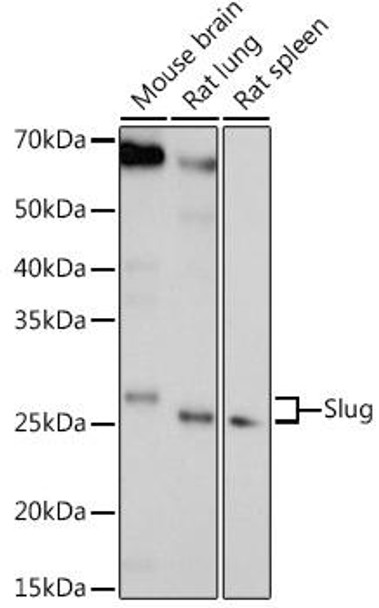 Epigenetics and Nuclear Signaling Antibodies 1 Anti-Slug Antibody CAB13352