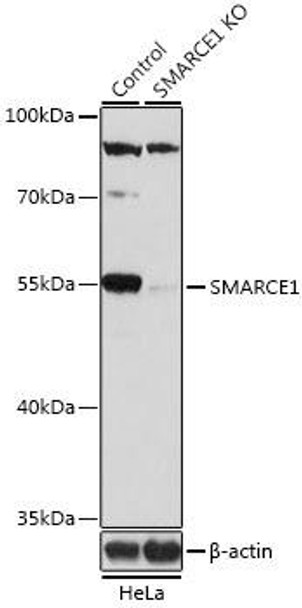 KO Validated Antibodies 1 Anti-SMARCE1 Antibody CAB13353KO Validated