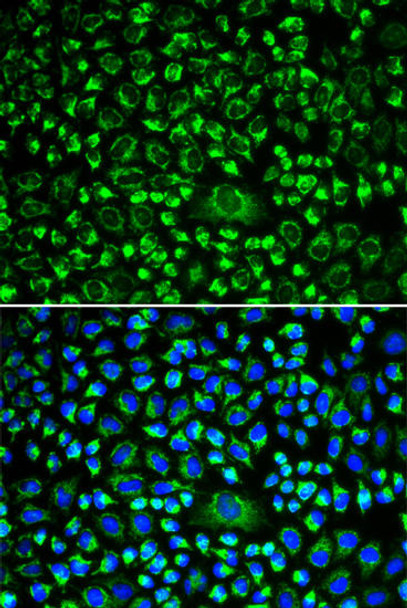 Cell Biology Antibodies 3 Anti-TAPBP Antibody CAB13357