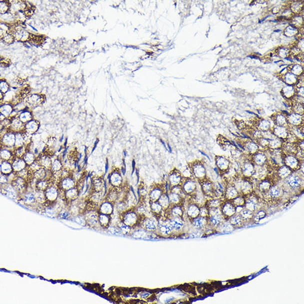 Cell Biology Antibodies 3 Anti-TCP1 Antibody CAB13364