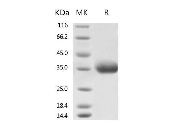 Recombinant 2019-nCoV Spike Protein RBD, His TagK458R