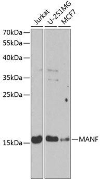 KO Validated Antibodies 1 Anti-MANF Antibody CAB13371KO Validated