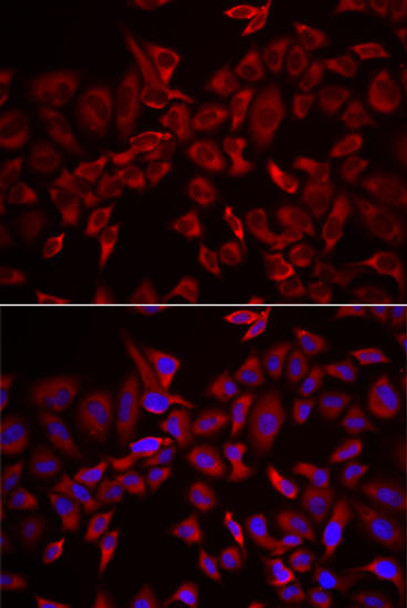 Developmental Biology Anti-CSRP3 Antibody CAB13372