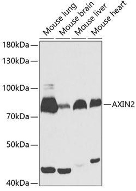 Metabolism Antibodies 1 Anti-AXIN2 Antibody CAB13373